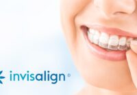 Invisalign Treatment In Bangalore