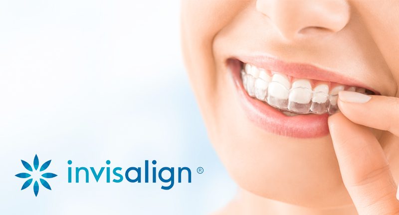 INVISALIGN TREATMENT IN BANGALORE