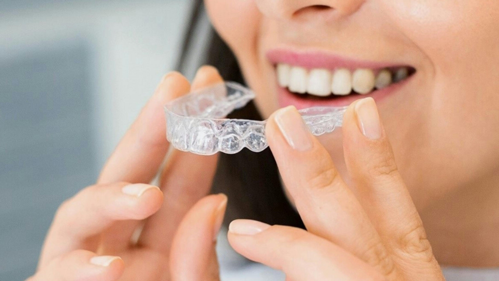 Clear aligners for smile correction
