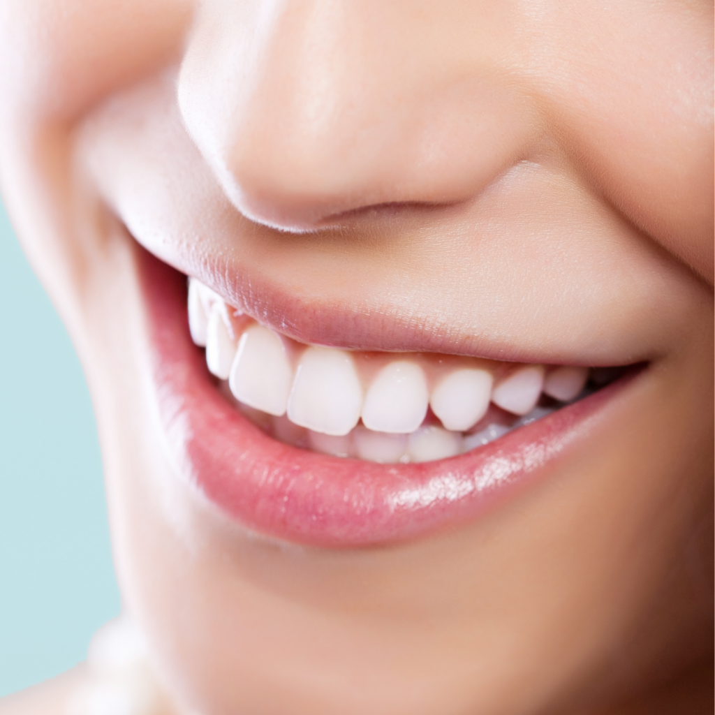 Hollywood smile makeover result