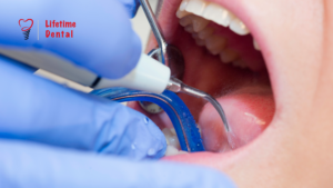 Importance of Teeth cleaning | Dental Scaling